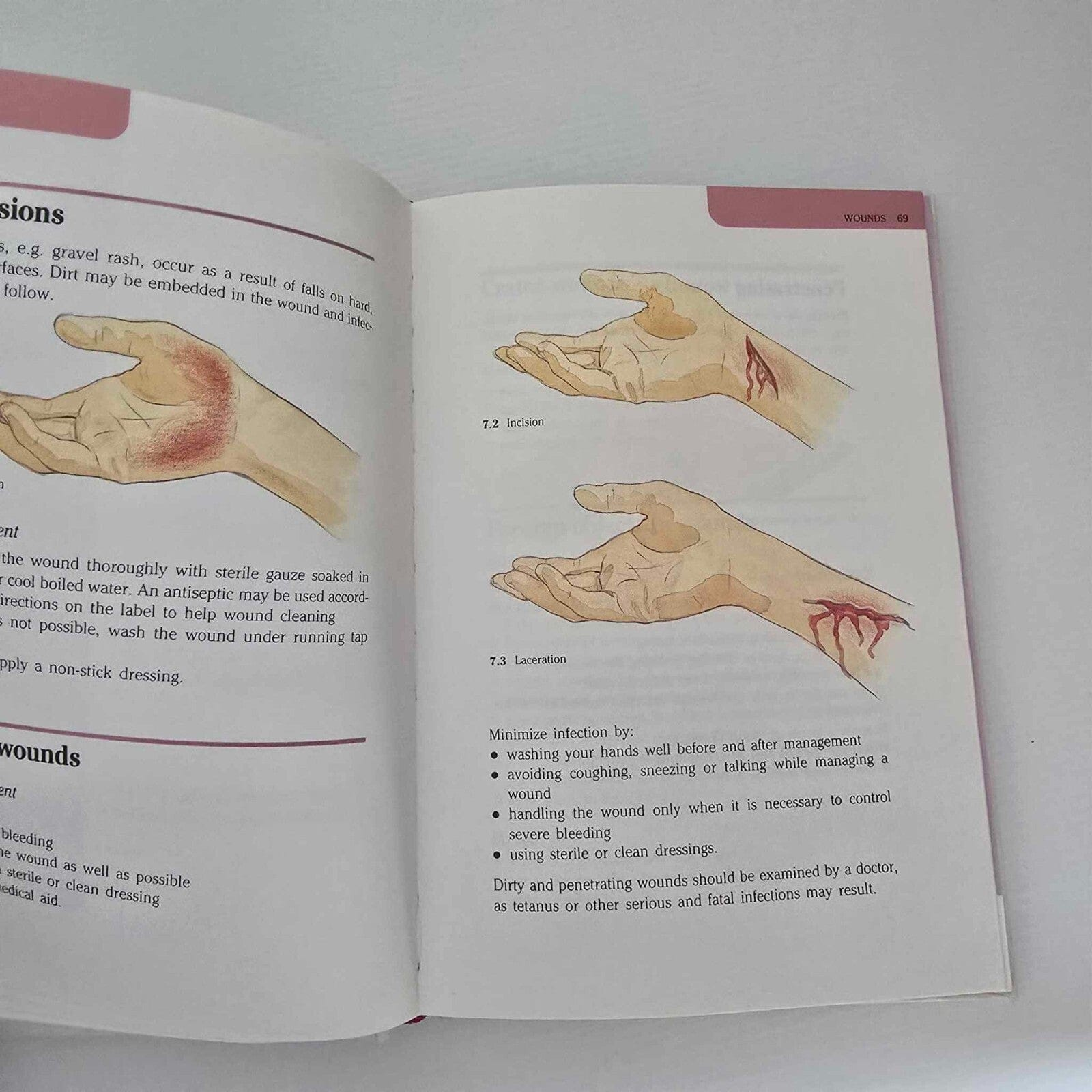 Alona.com.au Australian First Aid Volume One Authorised by St John Ambulance Australia, 1990